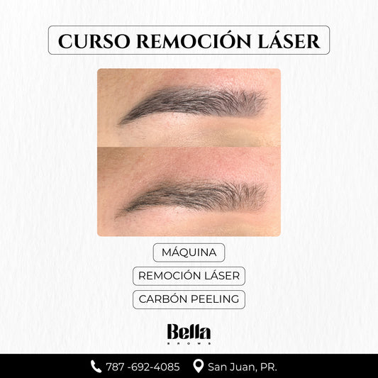Curso Remoción